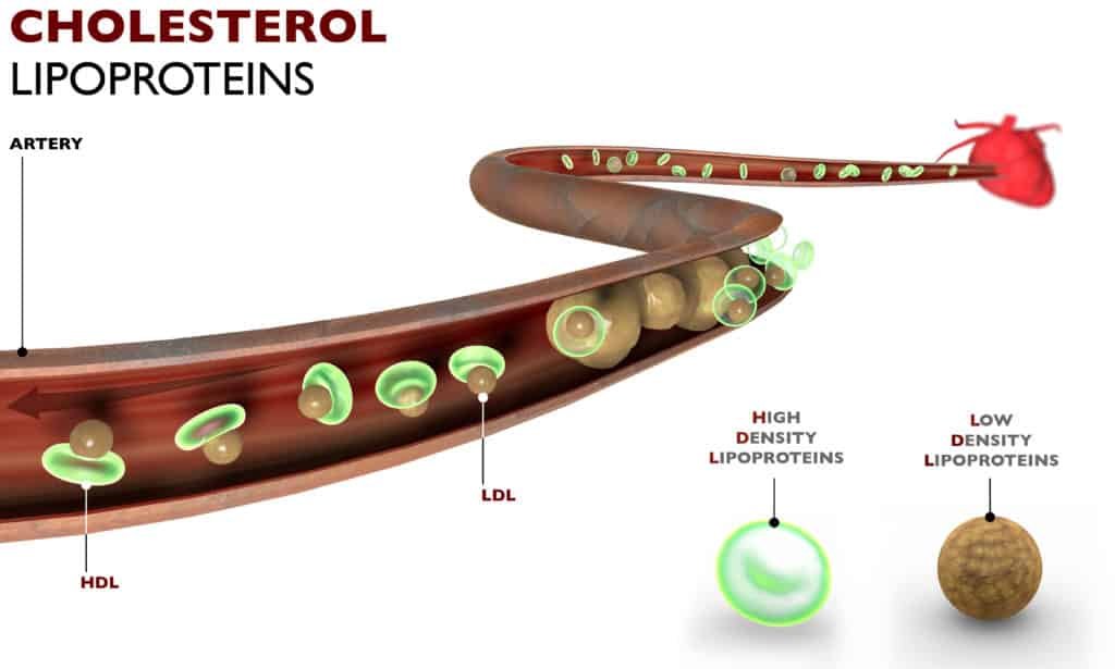 is keto bad for cholesterol?