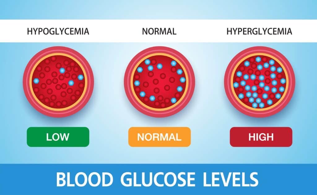 Hyperglycemia, High Blood Sugar and Diabetes 