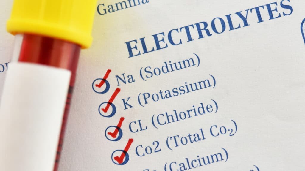 Best Bodybuilding Foods for Cutting: Optimize Fat Loss and Muscle Retention 6 Blood sample for electrolyte test